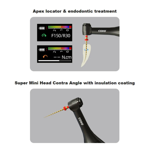 Endodontic Treatment Contactless Charging COXO C-SMART MINI AP+ Brushless Endo Motor Apex Locator,4 Working Modes,6:1Mini Head