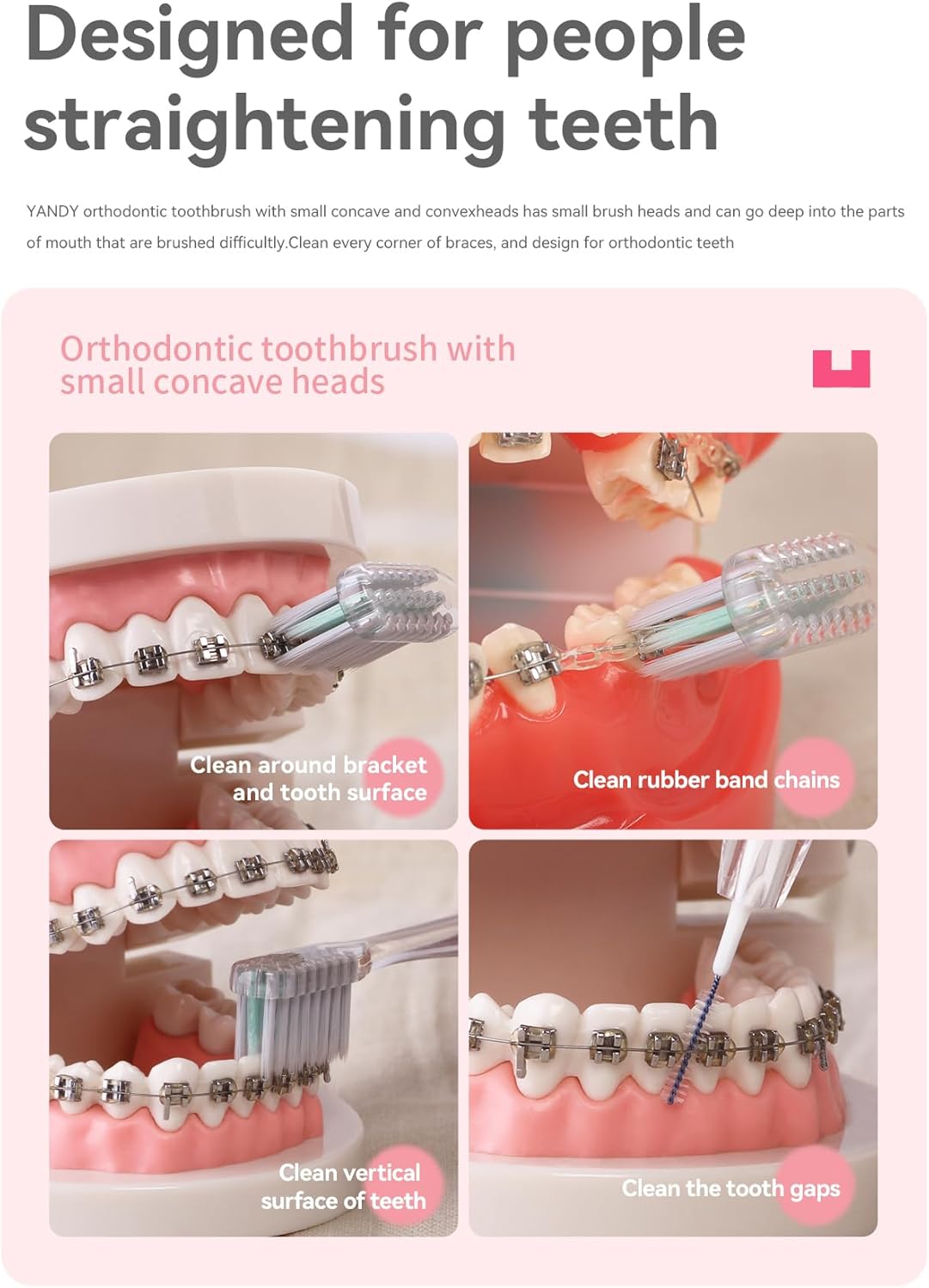 YANDY Concave Orthodontic Toothbrush for Braces Brackets, Pack of 1,Tail Self-Contained Interdental Brush, Soft Bristles