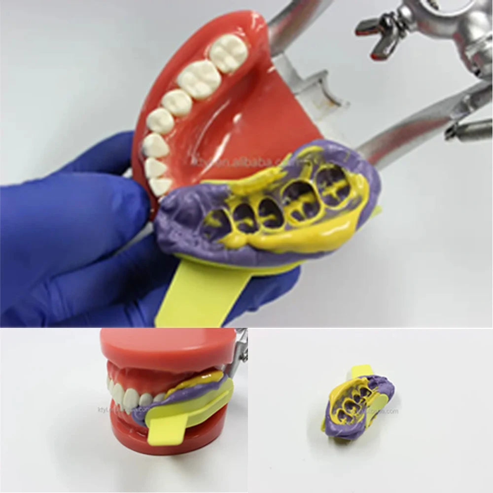 Dental Bite Trays Impression Partial Posterior Teeth Registration With Net 20pcs/Box Cotisen Disposable Dentist Tools Instrument