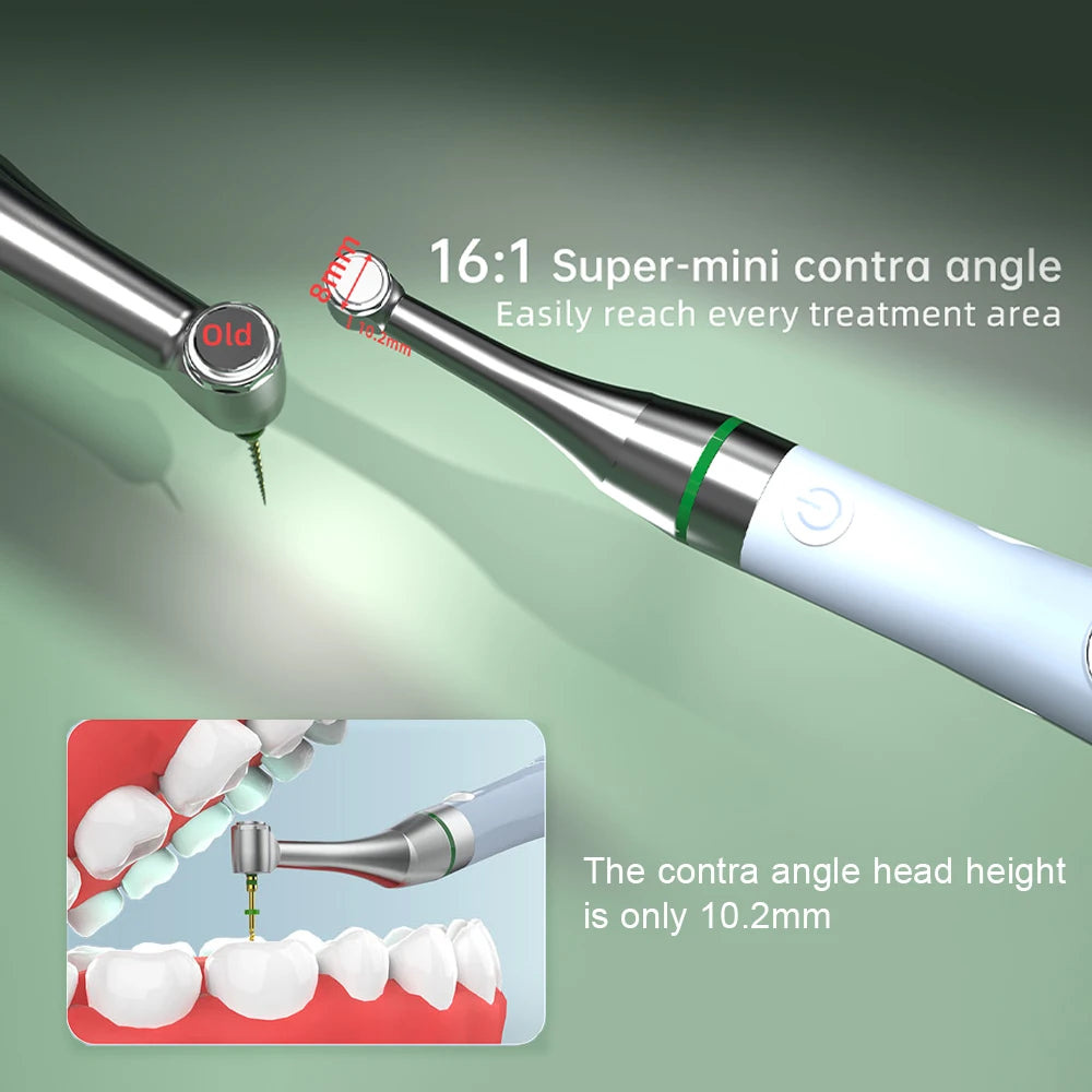 Dental Endo Motor COXO C-SMART NOVA Wireless 16:1 Head 360° Adjustable Handpiece for Root Canal Treat T-Mode Endodontic Motor