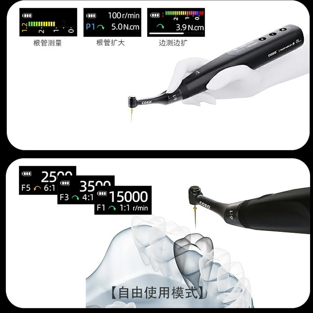 Endodontic Treatment Contactless Charging COXO C-SMART MINI AP+ Brushless Endo Motor Apex Locator,4 Working Modes,6:1Mini Head