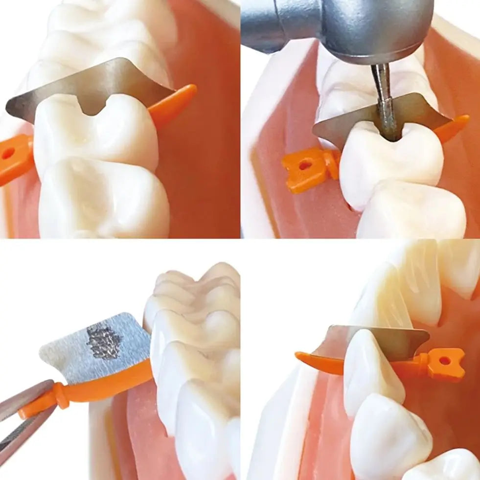 Dentpark/24Pcs or 72Pcs Dental Matrix Wedge Guards M3 Being placed before preparation to protect adjacent tooth Dentistry tool