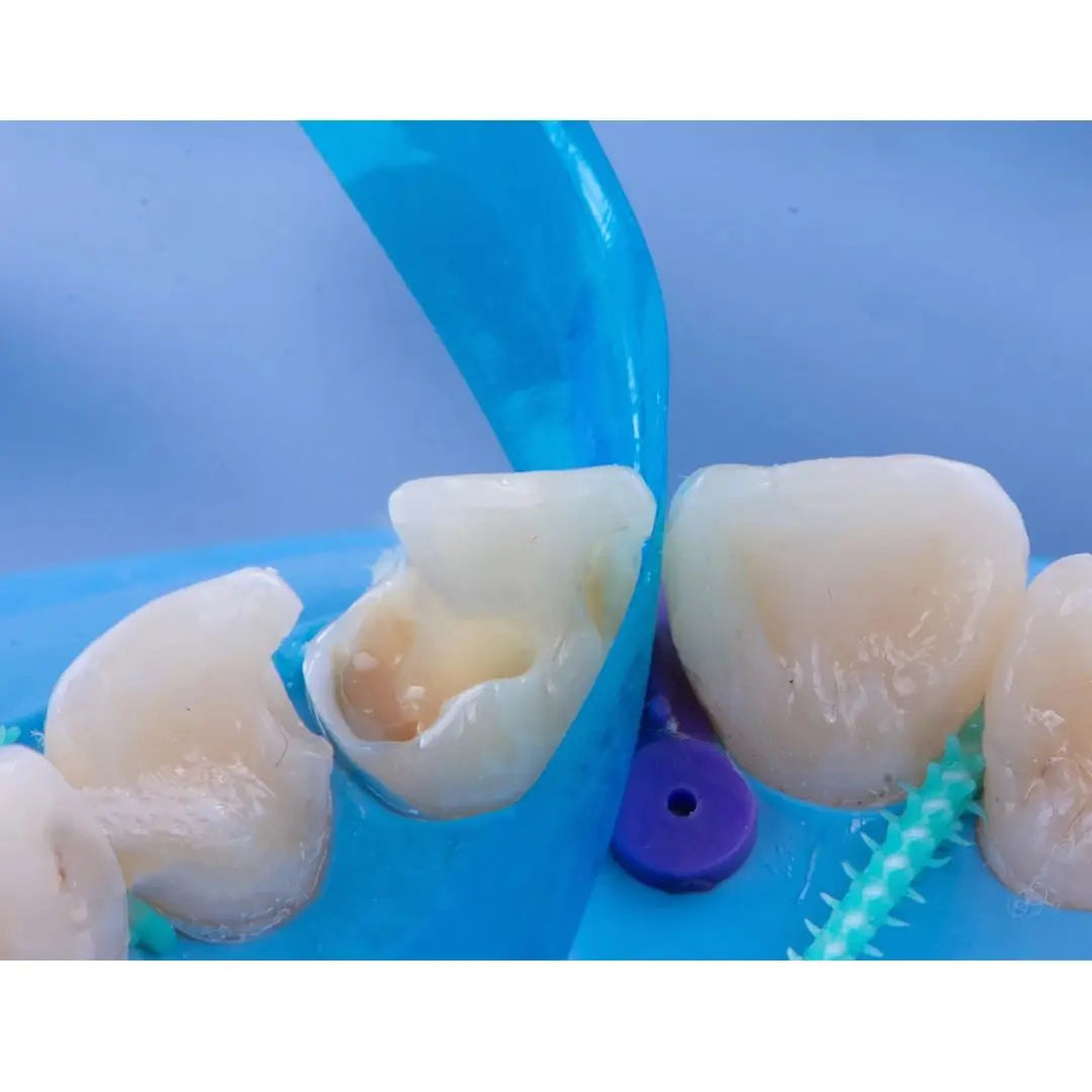 Dentpark/Dental contoured anterior matrix M8 50PCS Blue Transparent or 30PCS stainless steel Dentistry tools