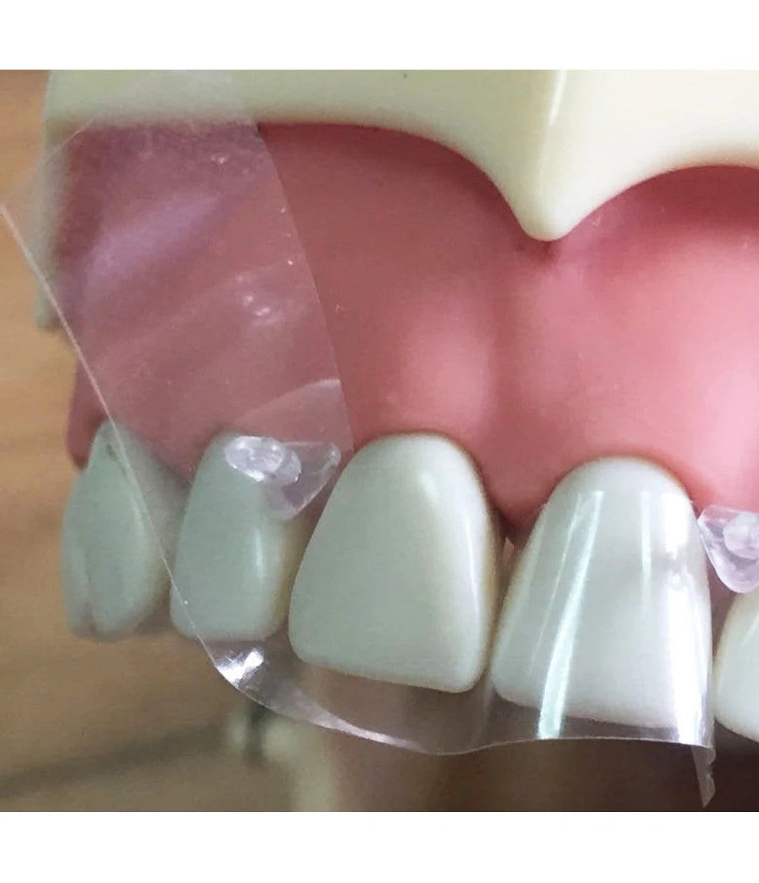 Dentpark Dental Strip Roll Matrix Bands Stainless Steel or Clear Polyester Film Sectional Contoured Matrices Dentistry Tools
