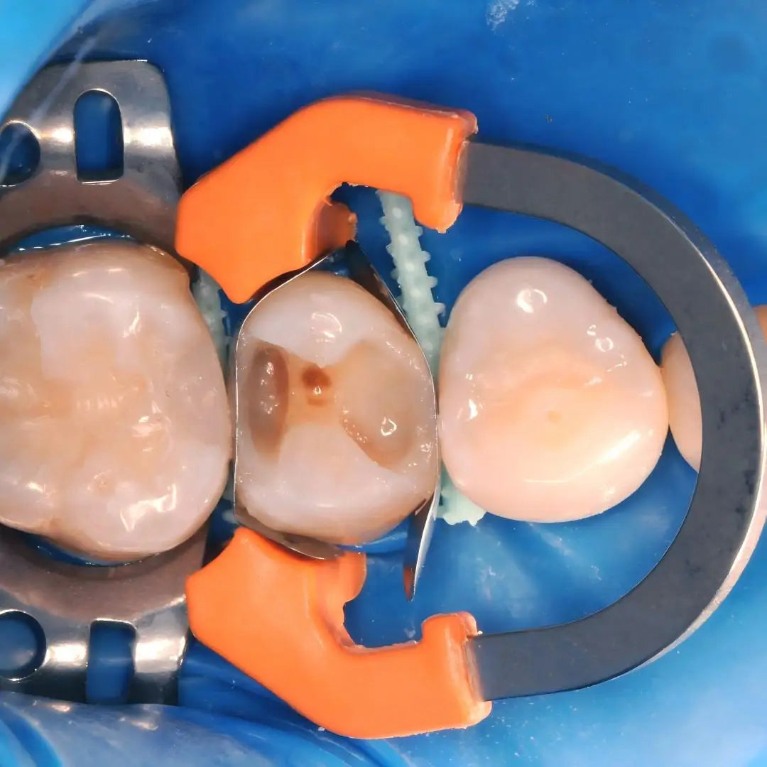Dentpark Dental Sectional Matrix System D3 - 50pcs Matrix Bands &1 NITI Clamp Ring R7 for class-Ⅱ Composite Resin restoration